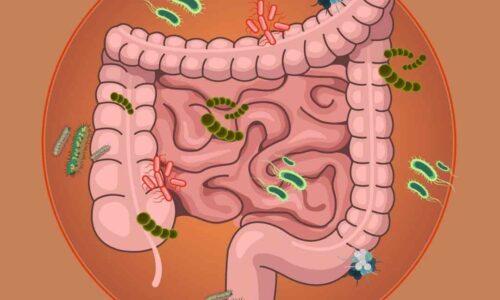 Curso SIBO para pacientes (actualización 2024)