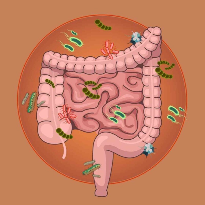 Curso SIBO para pacientes